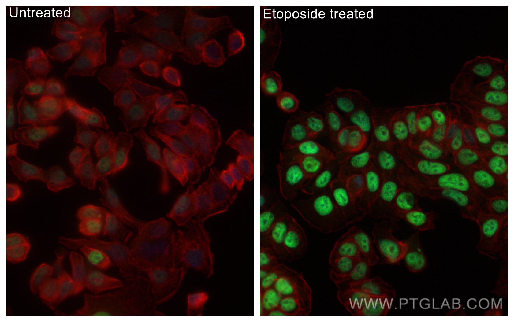 IF Staining of HT-29 using 28961-1-AP