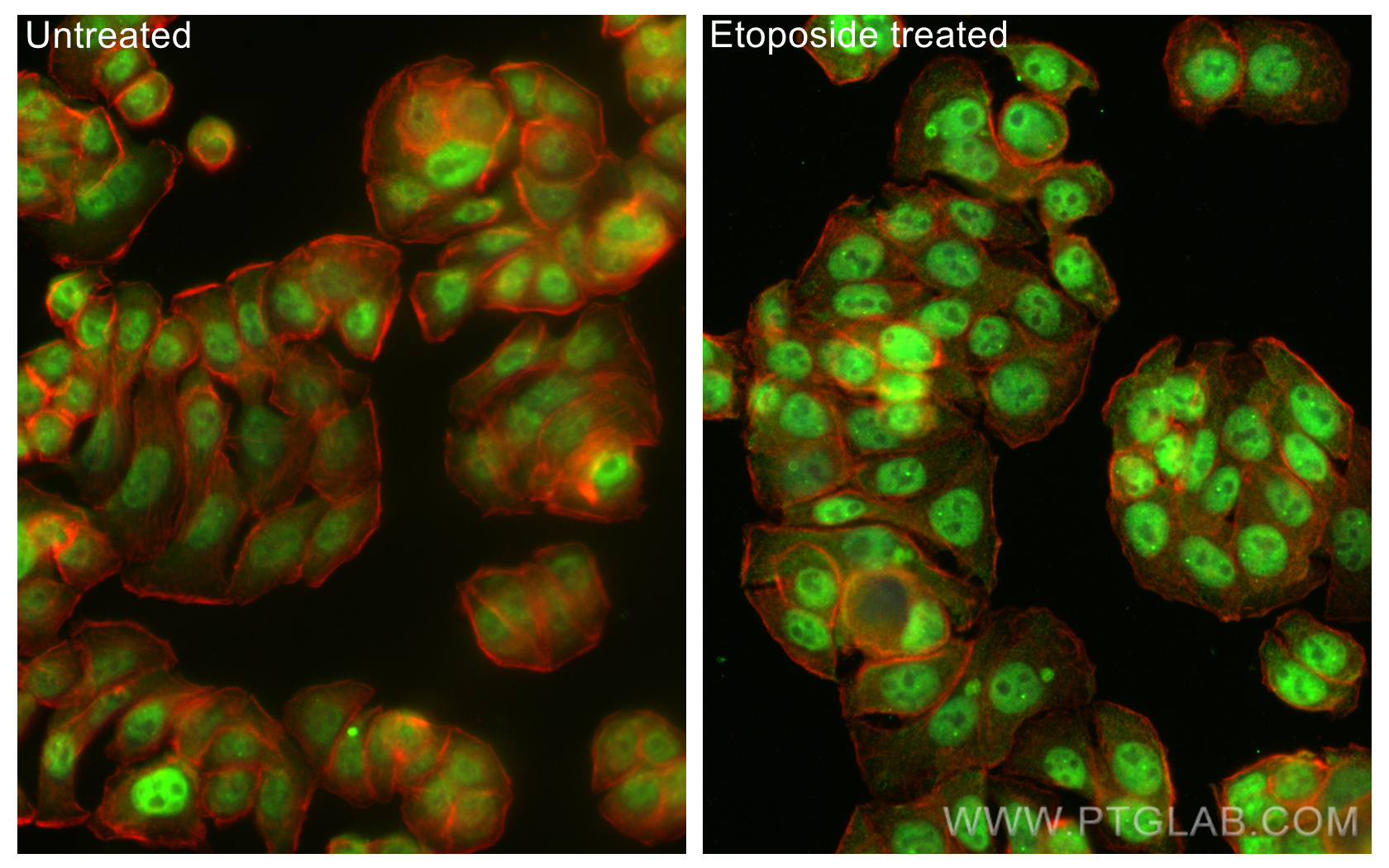 IF Staining of HT-29 using 67826-1-Ig