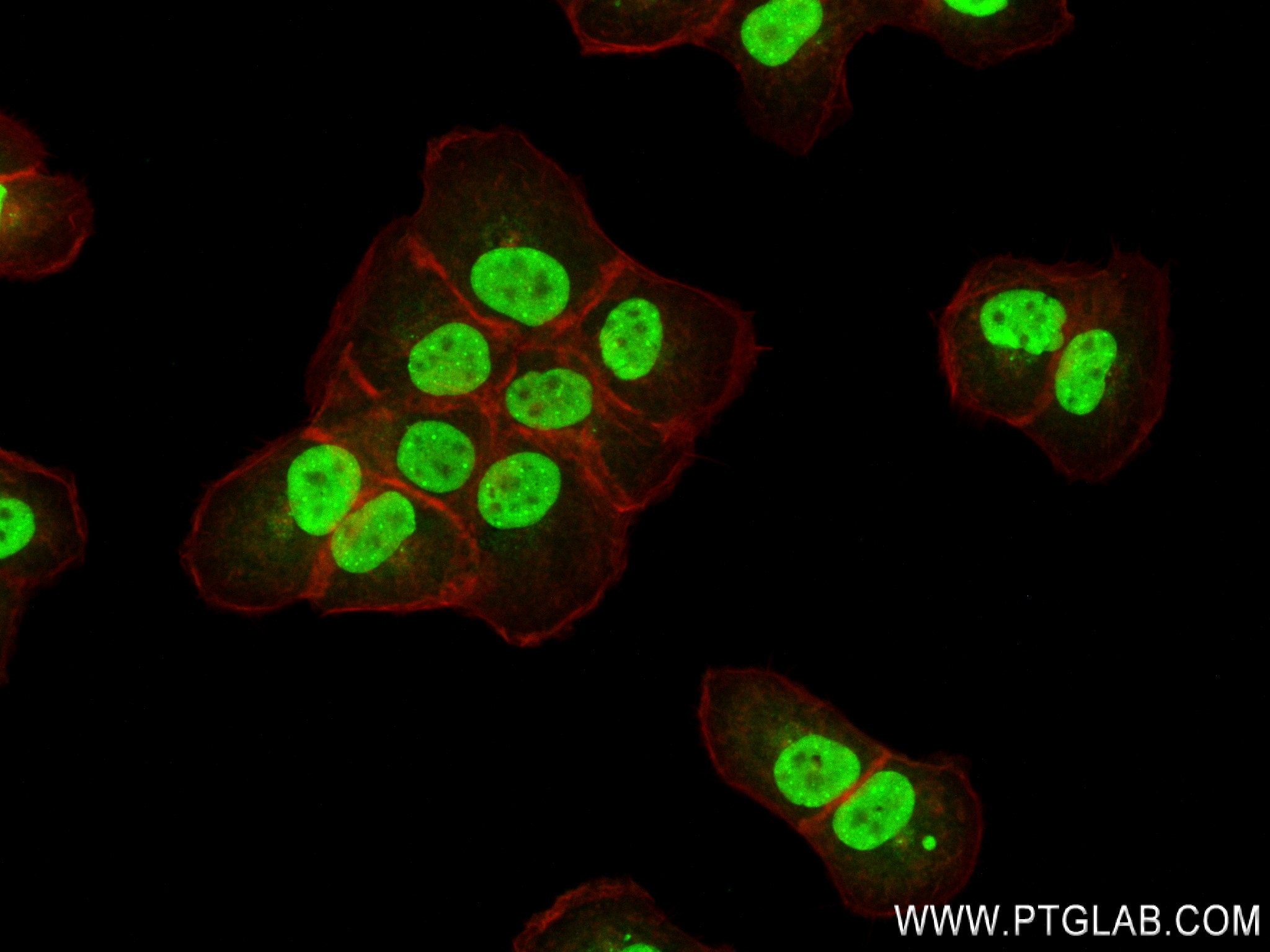 IF Staining of A431 using 80077-2-RR (same clone as 80077-2-PBS)