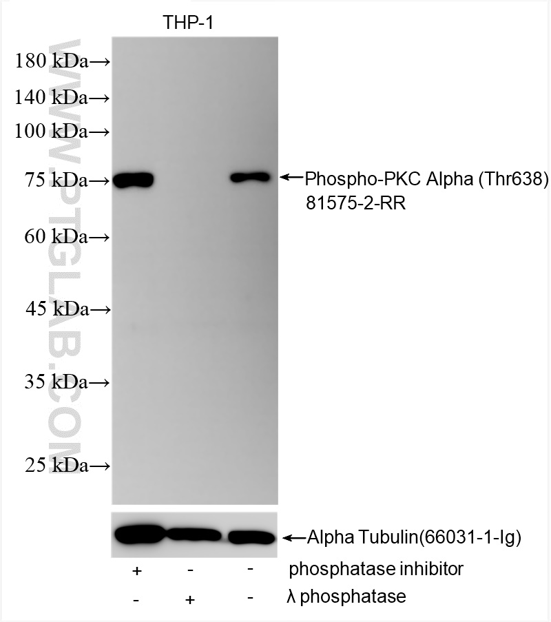 Phospho-PKC Alpha (Thr638)