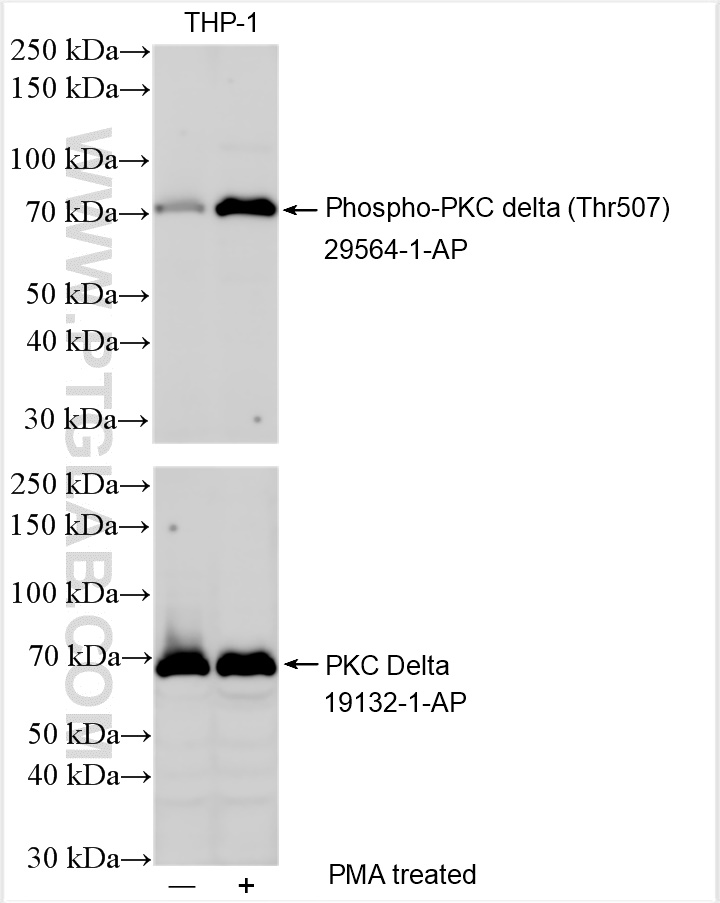 Phospho-PKC Delta (Thr507)