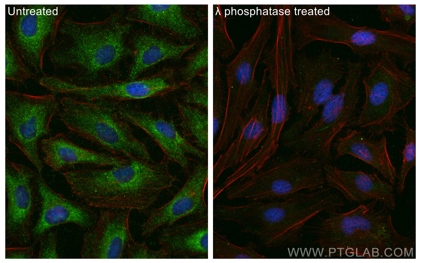 IF Staining of HeLa using 28925-1-AP (same clone as 28925-1-PBS)