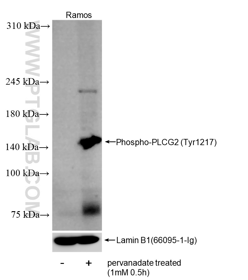 Phospho-PLCG2 (Tyr1217)