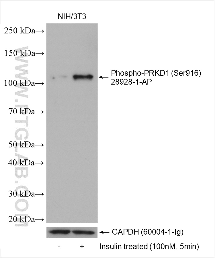 Phospho-PRKD1 (Ser916)