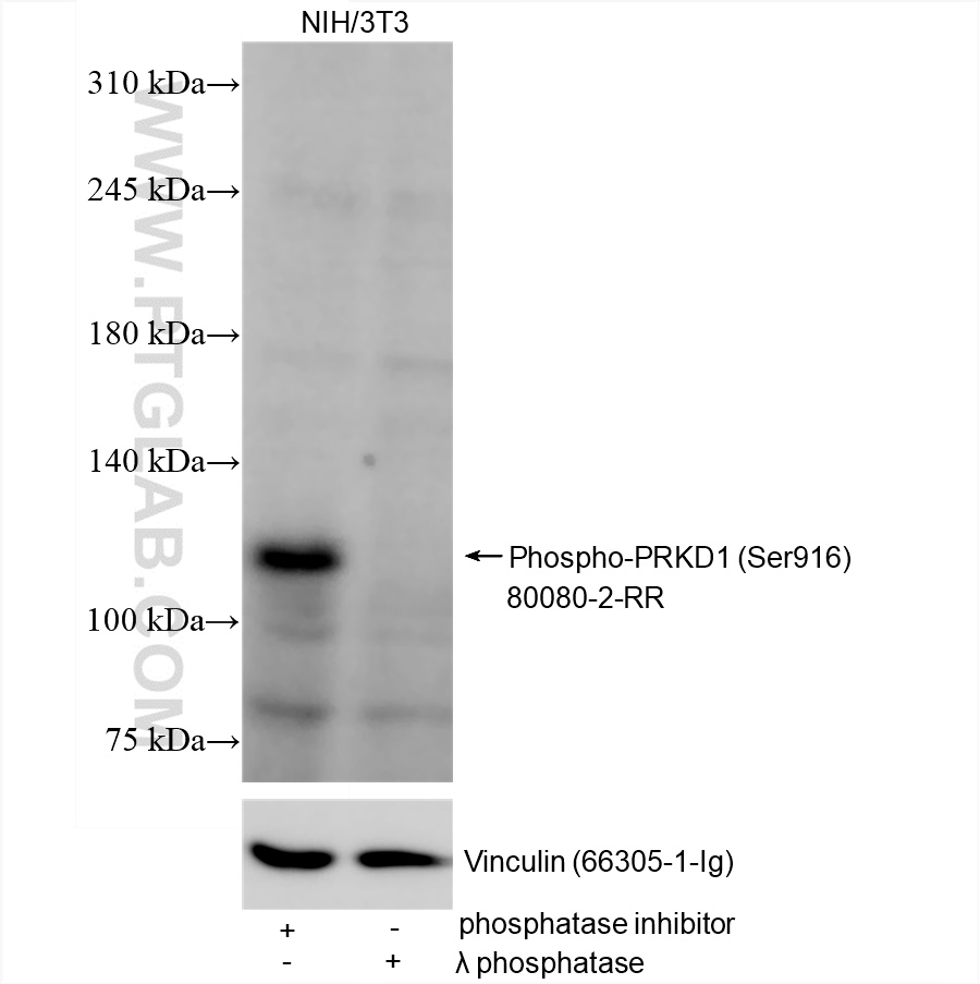 Phospho-PRKD1 (Ser916)