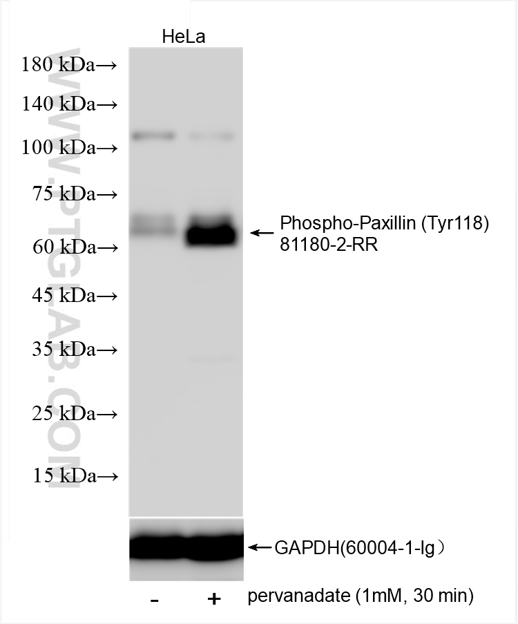 WB analysis using 81180-2-RR (same clone as 81180-2-PBS)