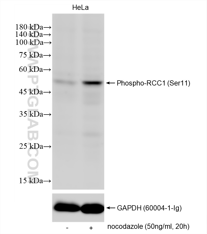 WB analysis using 83630-1-RR (same clone as 83630-1-PBS)