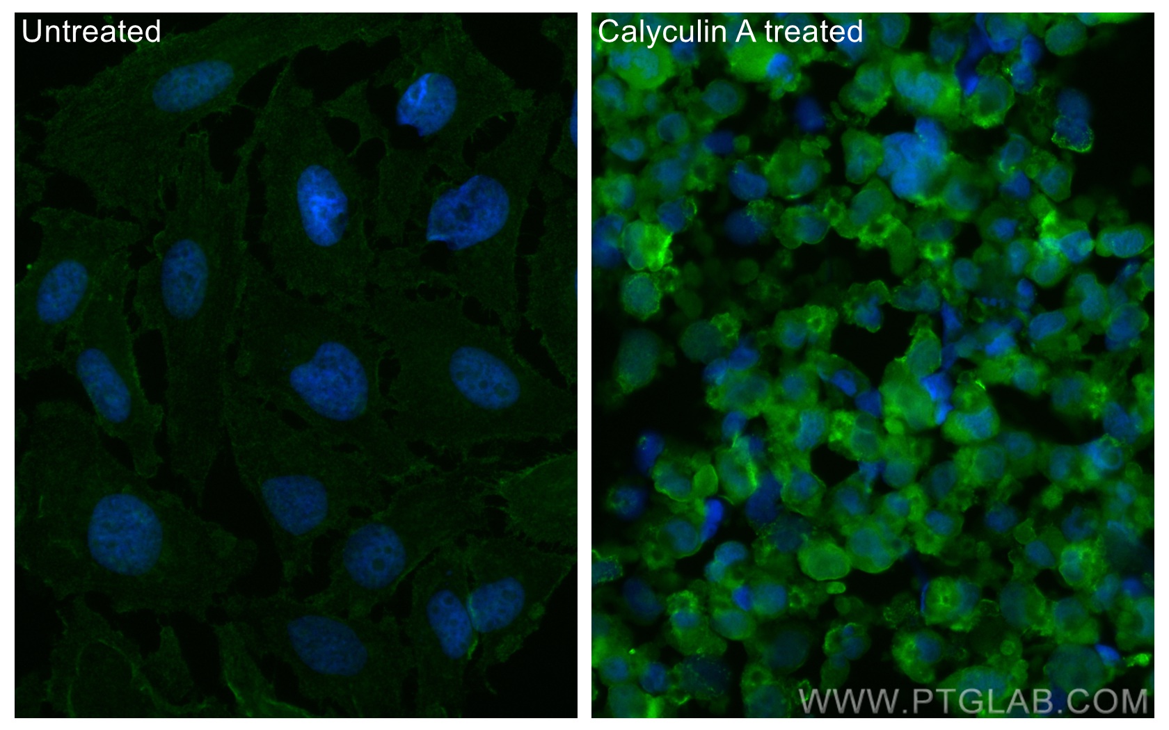 IF Staining of HeLa using CL488-66854