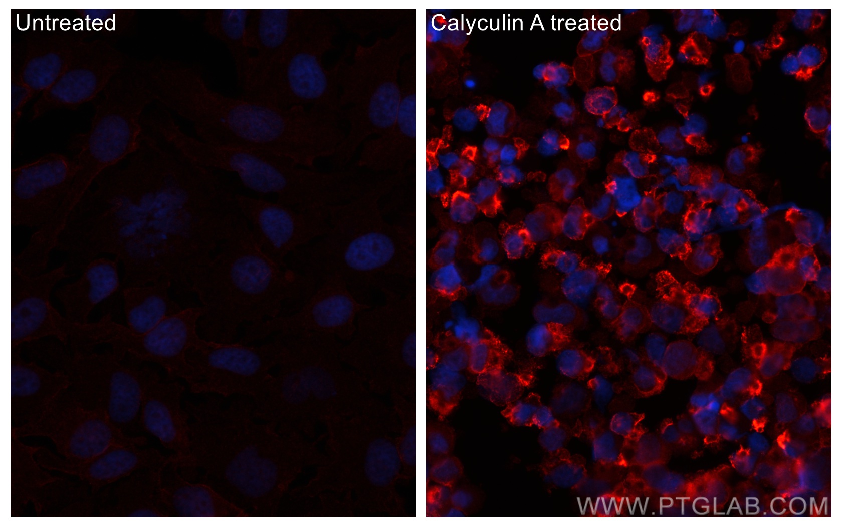 IF Staining of HeLa using CL594-66854