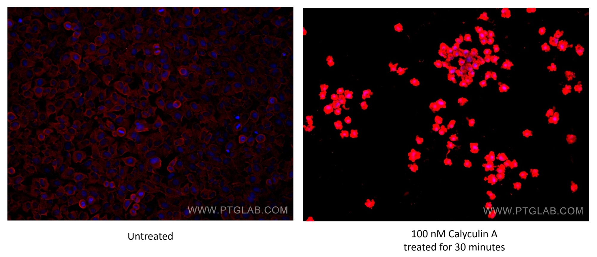 IF Staining of HeLa using 80130-2-RR (same clone as 80130-2-PBS)