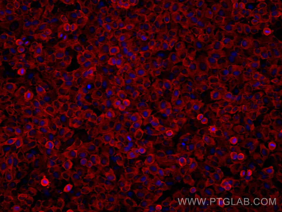 Phospho-S6 Ribosomal protein (Ser235)