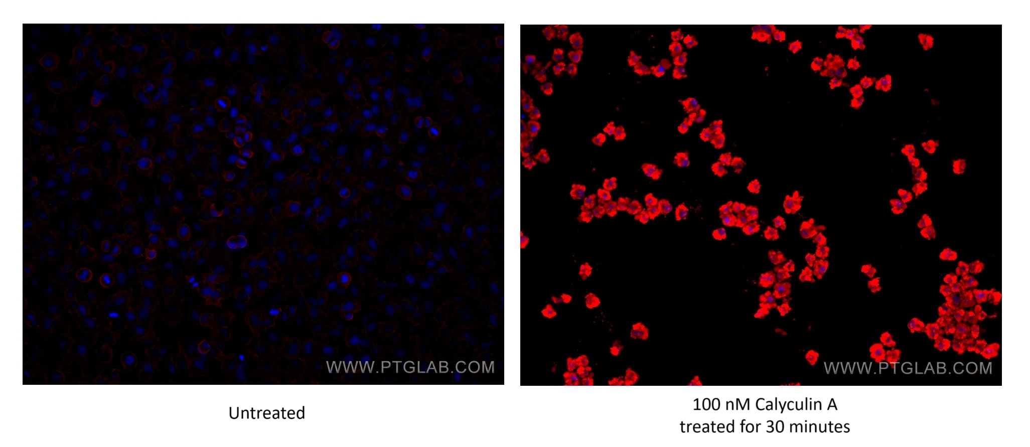 IF Staining of HeLa using 67898-1-Ig (same clone as 67898-1-PBS)