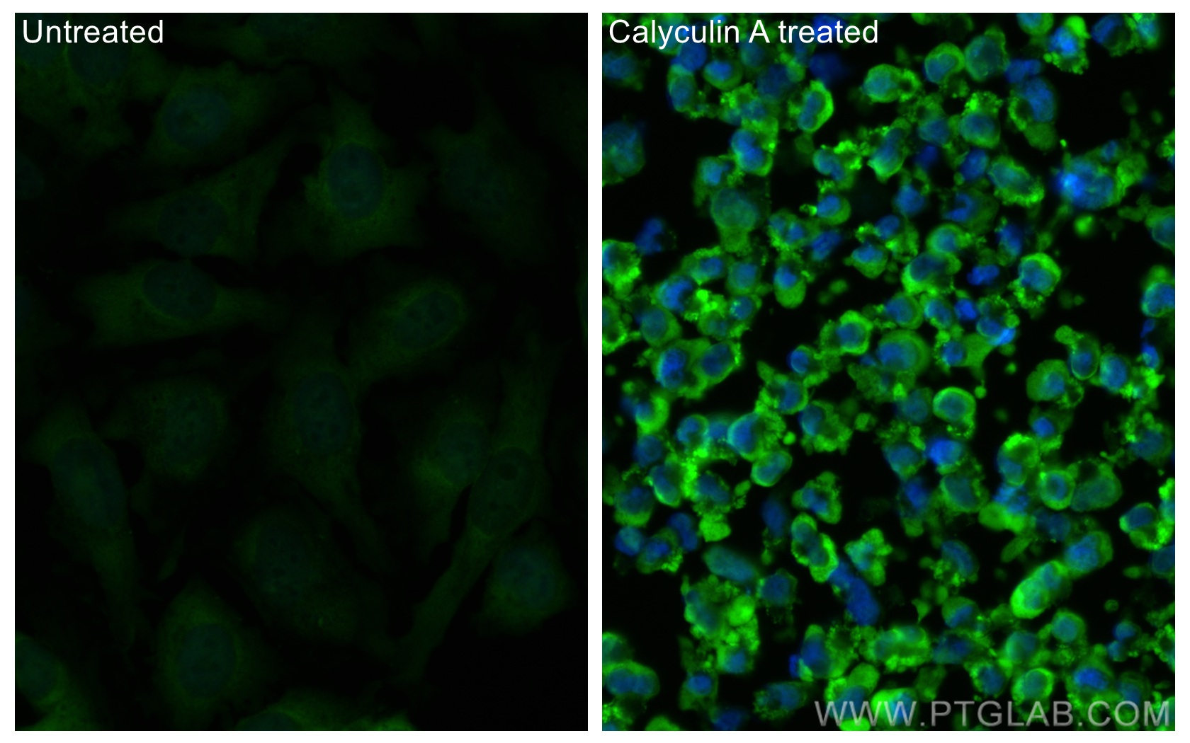 IF Staining of HeLa using CL488-67898