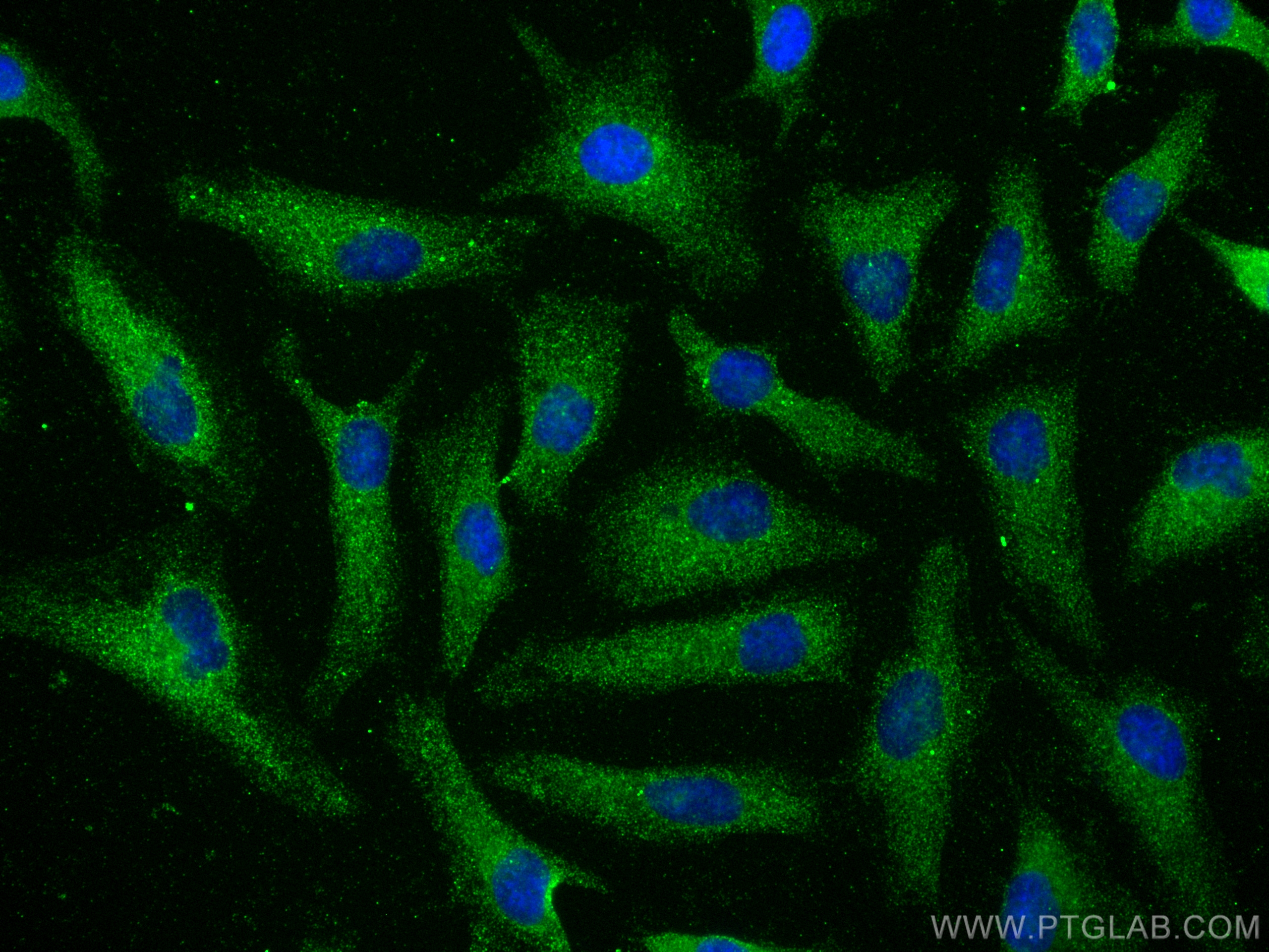 IF Staining of HeLa using 80108-1-RR