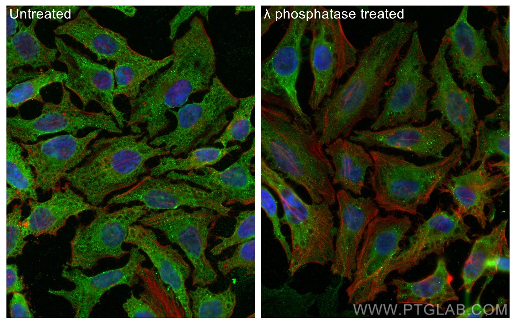 IF Staining of HeLa using 68041-1-Ig (same clone as 68041-1-PBS)