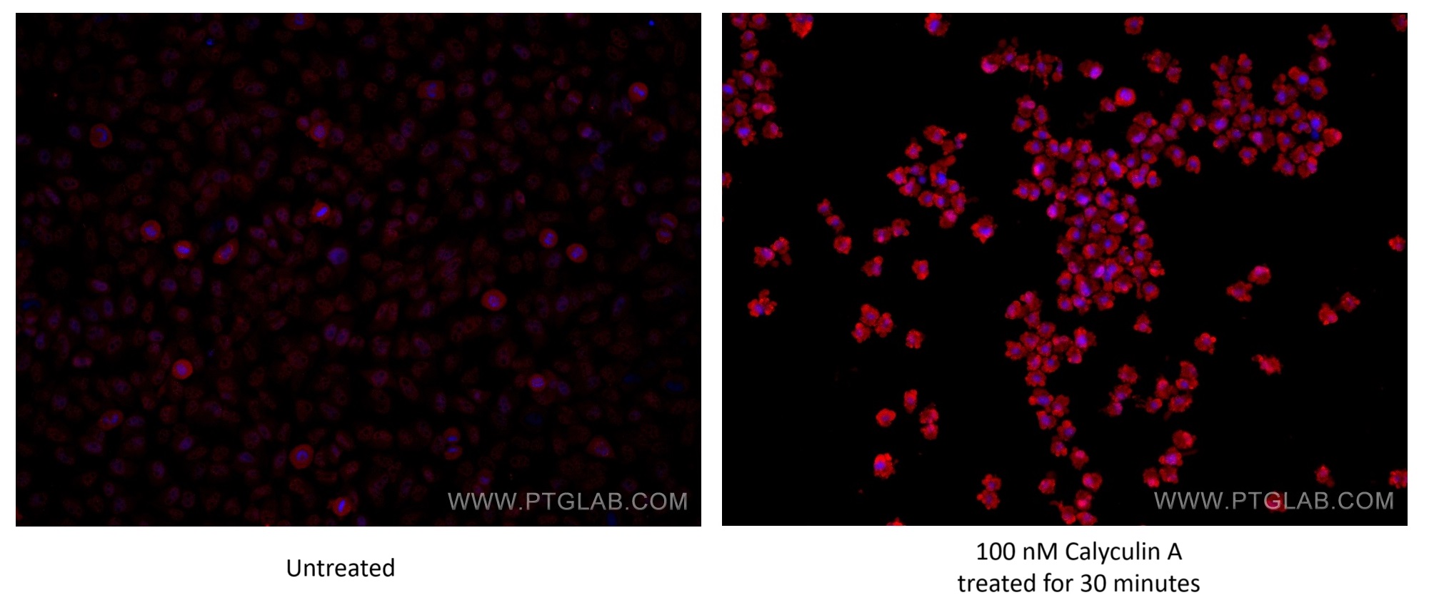 IF Staining of HeLa using 81184-1-RR (same clone as 81184-1-PBS)