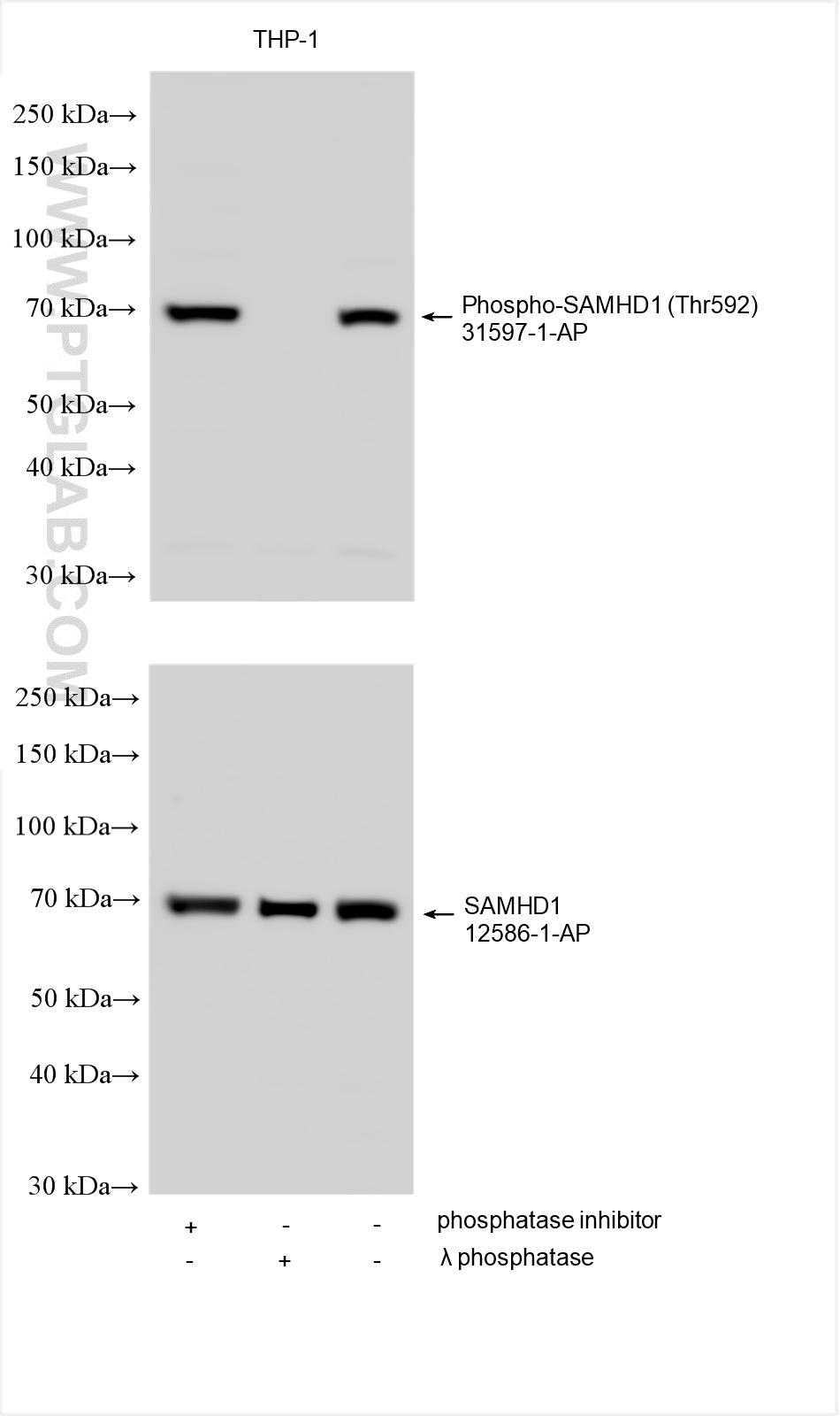 Phospho-SAMHD1 (Thr592)