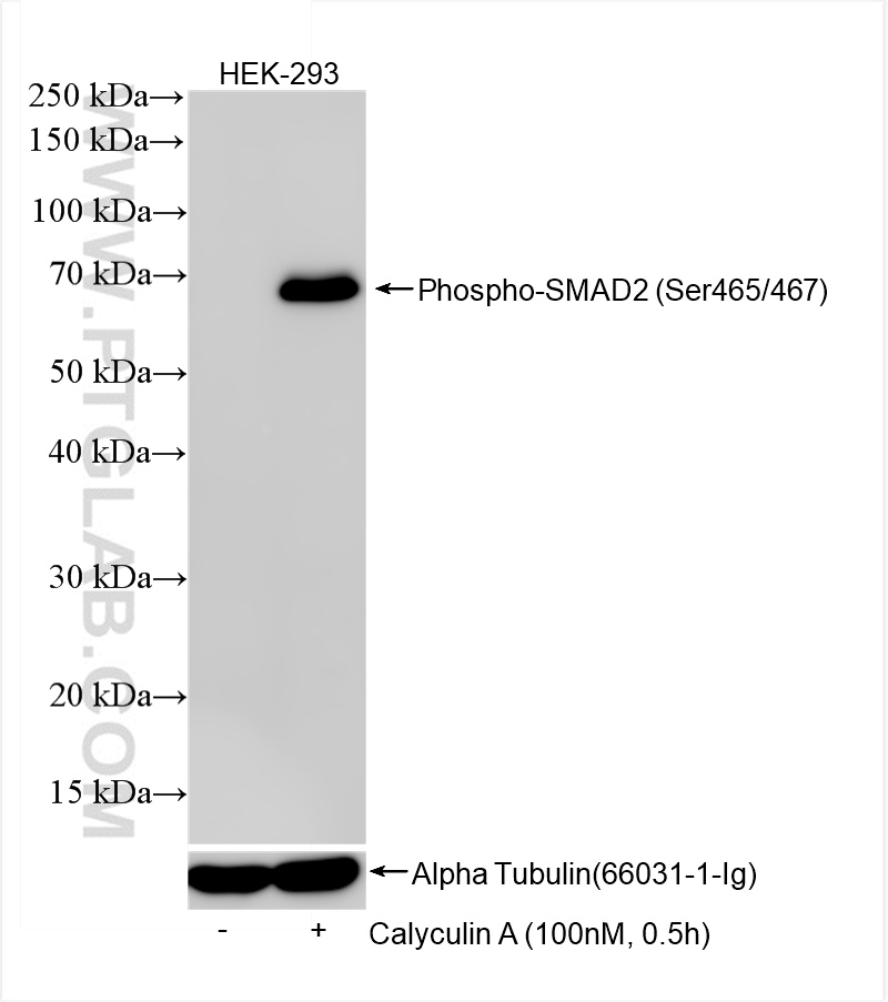 Phospho-SMAD2 (Ser465/467)