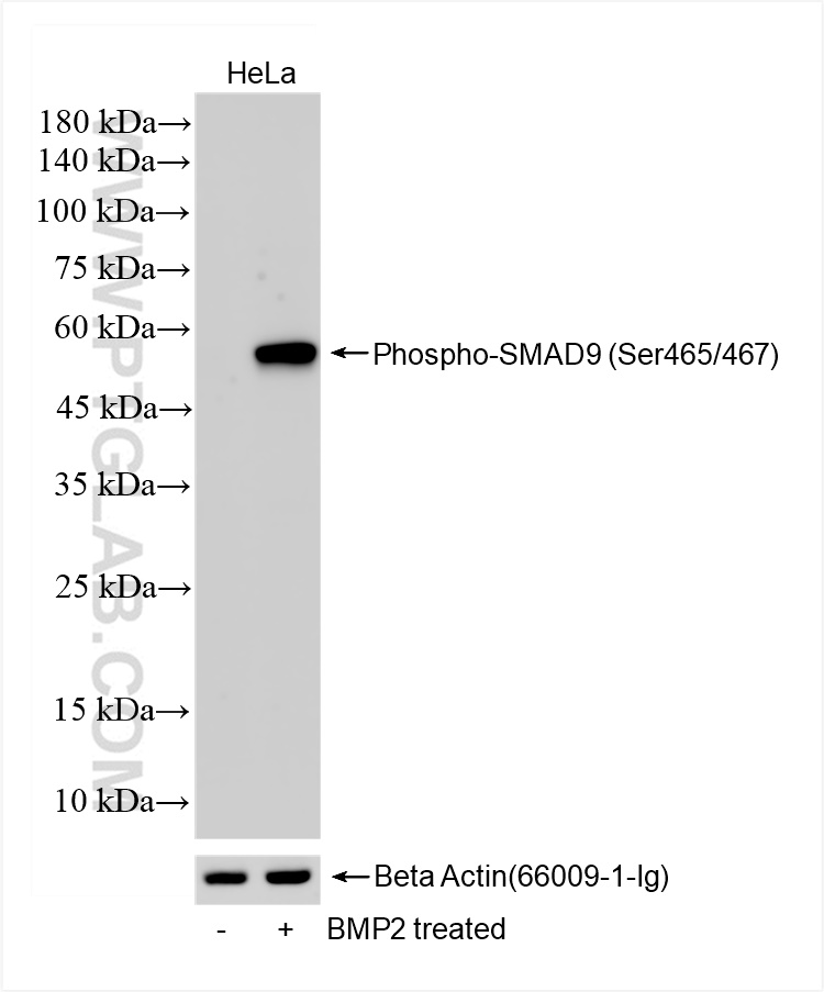 WB analysis of HeLa using 80144-2-RR (same clone as 80144-2-PBS)