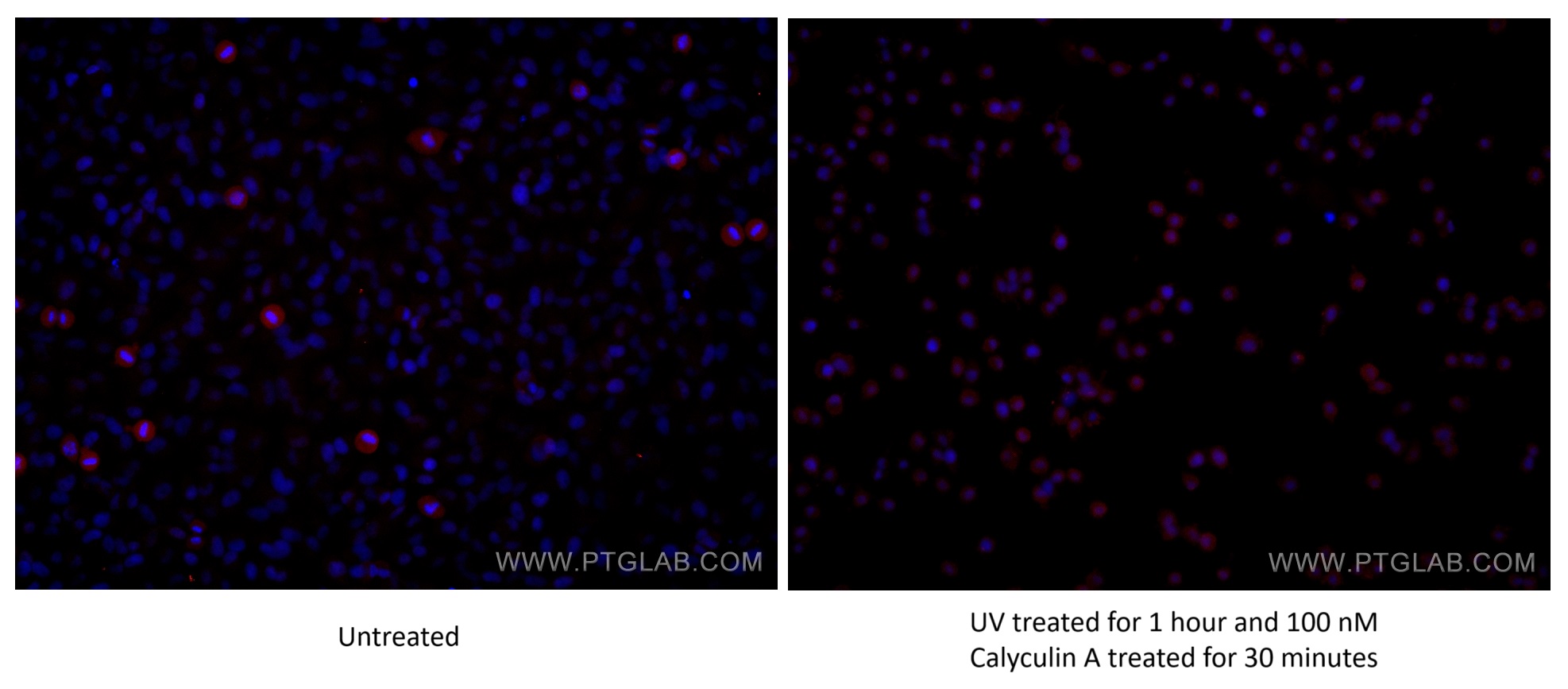 IF Staining of HeLa using 60479-1-Ig (same clone as 60479-1-PBS)