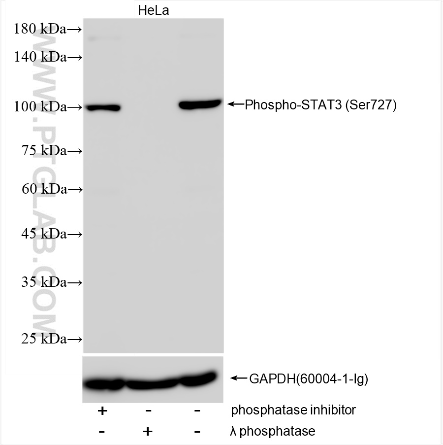 Phospho-STAT3 (Ser727)