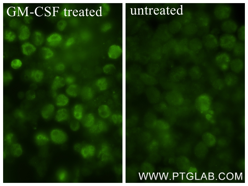 Phospho-STAT5A (Ser726)/STAT5B (Ser731)