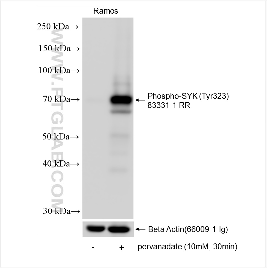 WB analysis of Ramos using 83331-1-RR (same clone as 83331-1-PBS)