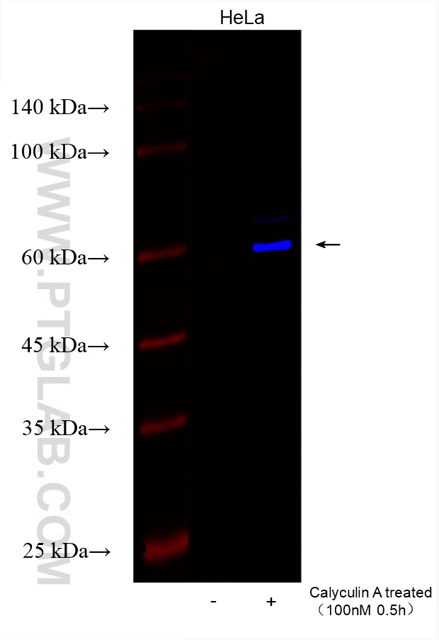 WB analysis using CL750-81785