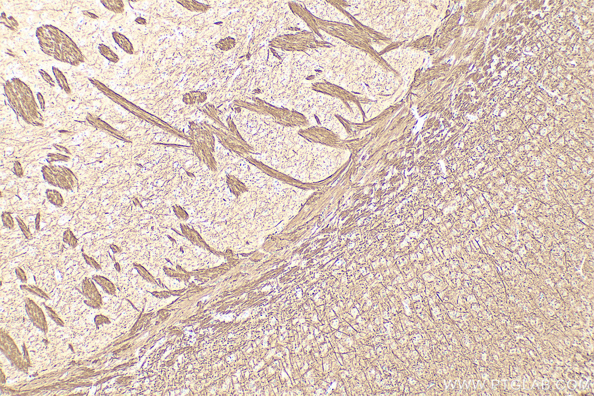 IHC staining of mouse brain using 28866-1-AP