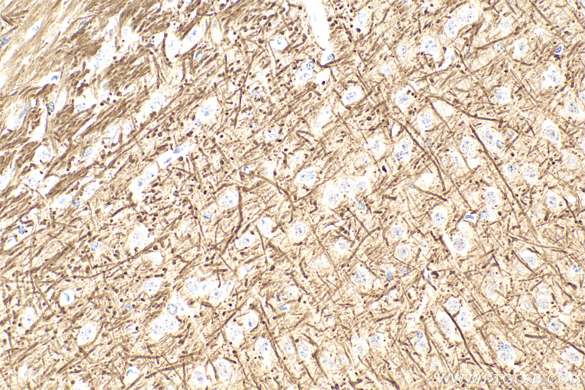 IHC staining of mouse brain using 28866-1-AP