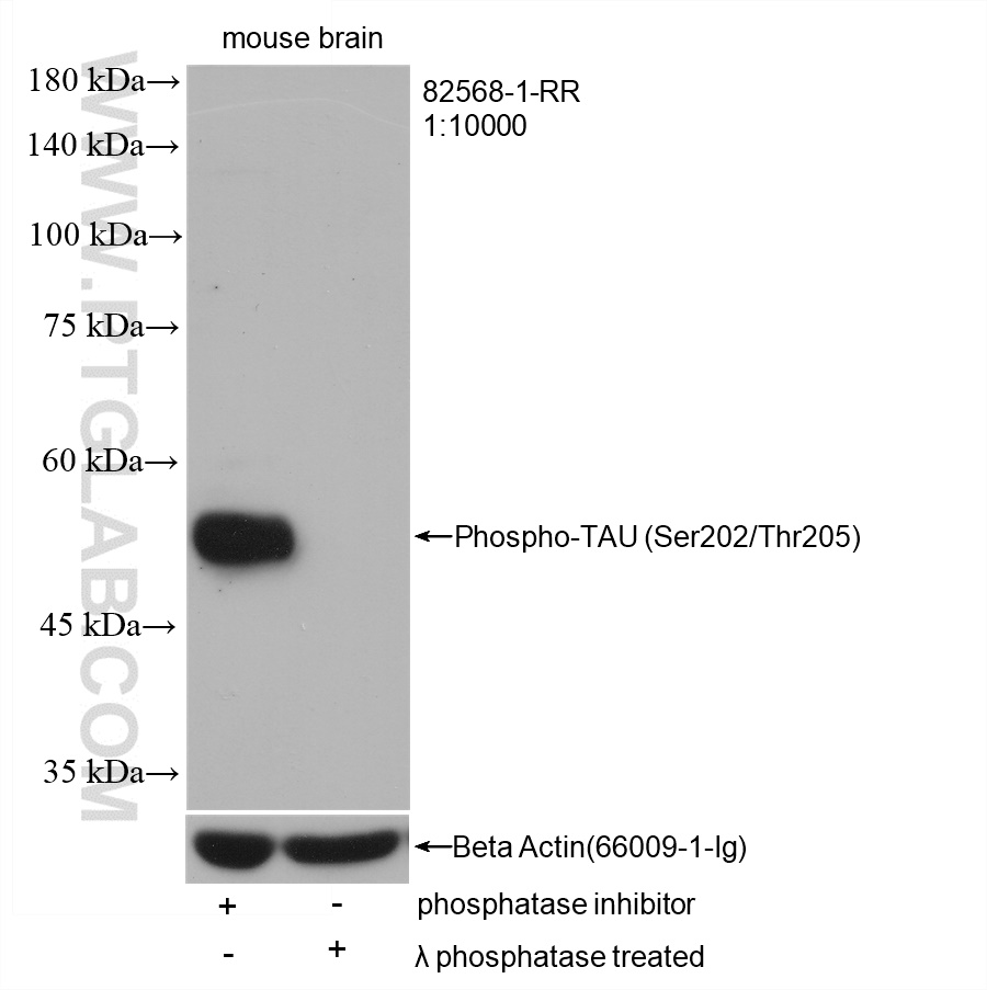 WB analysis of mouse brain using 82568-1-RR (same clone as 82568-1-PBS)