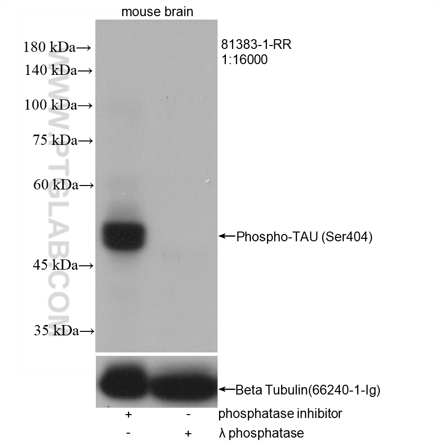 WB analysis of mouse brain using 81383-1-RR