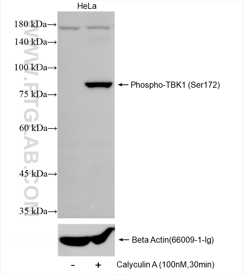 Phospho-TBK1 (Ser172)