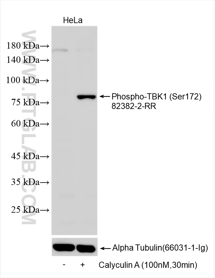 WB analysis using 82382-2-RR (same clone as 82382-2-PBS)