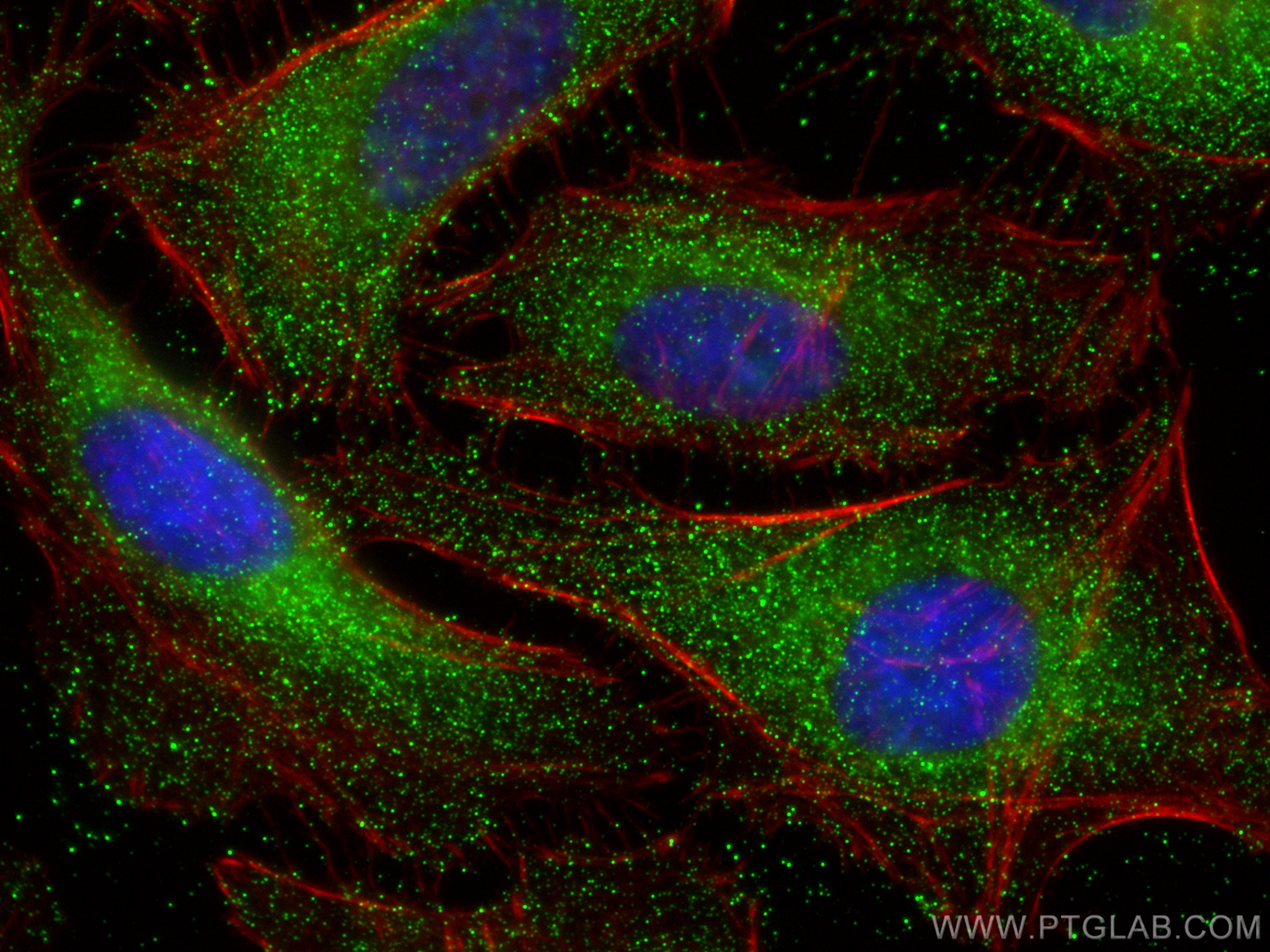 IF Staining of HeLa using 29006-1-AP