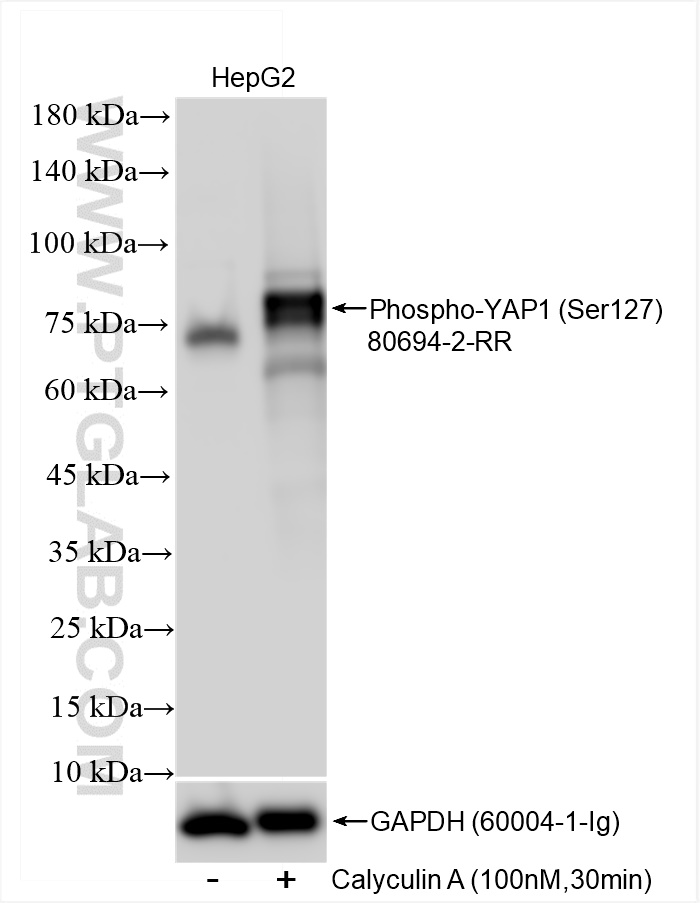 Phospho-YAP1 (Ser127)