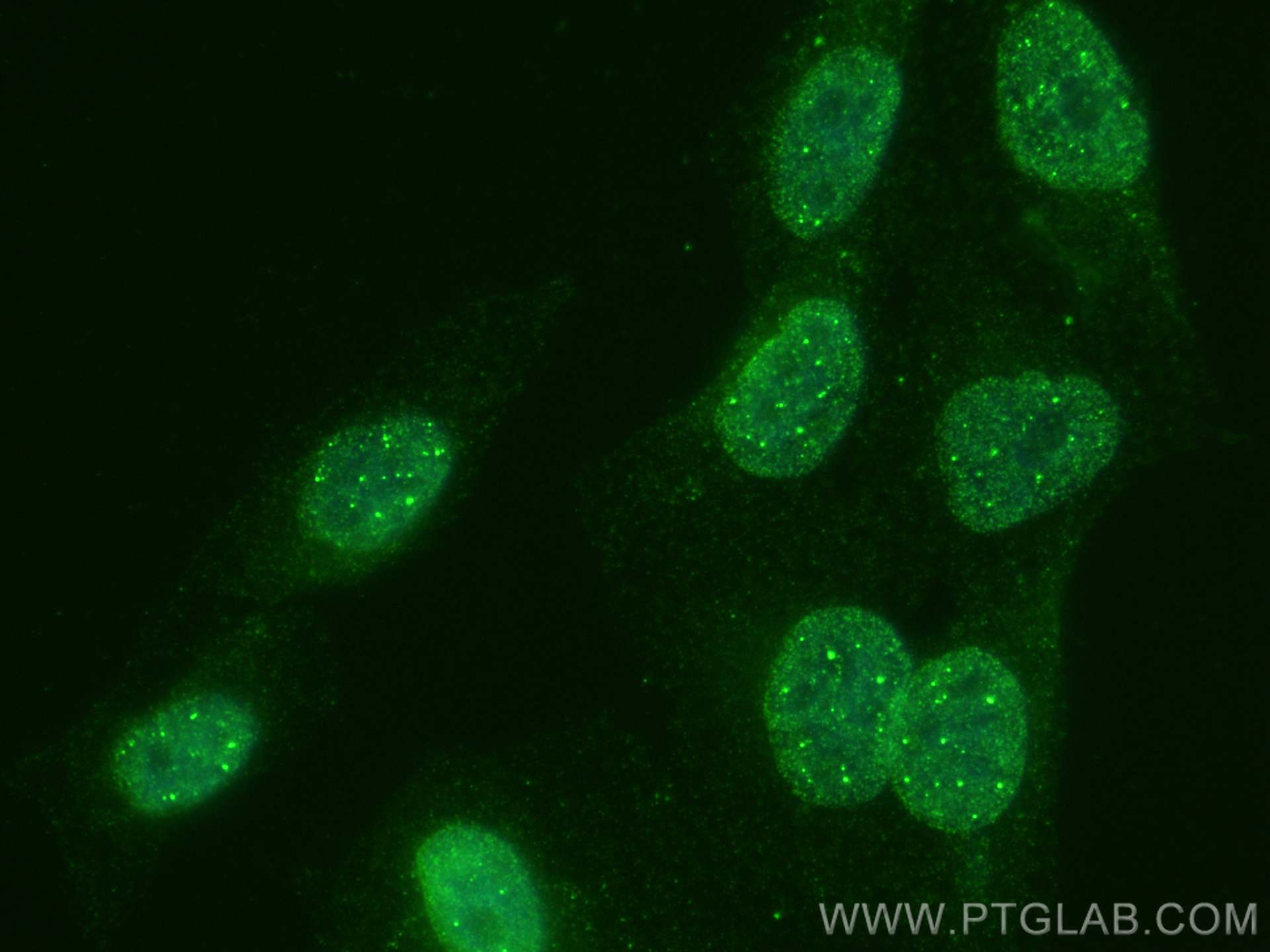 IF Staining of HepG2 using 28796-1-AP