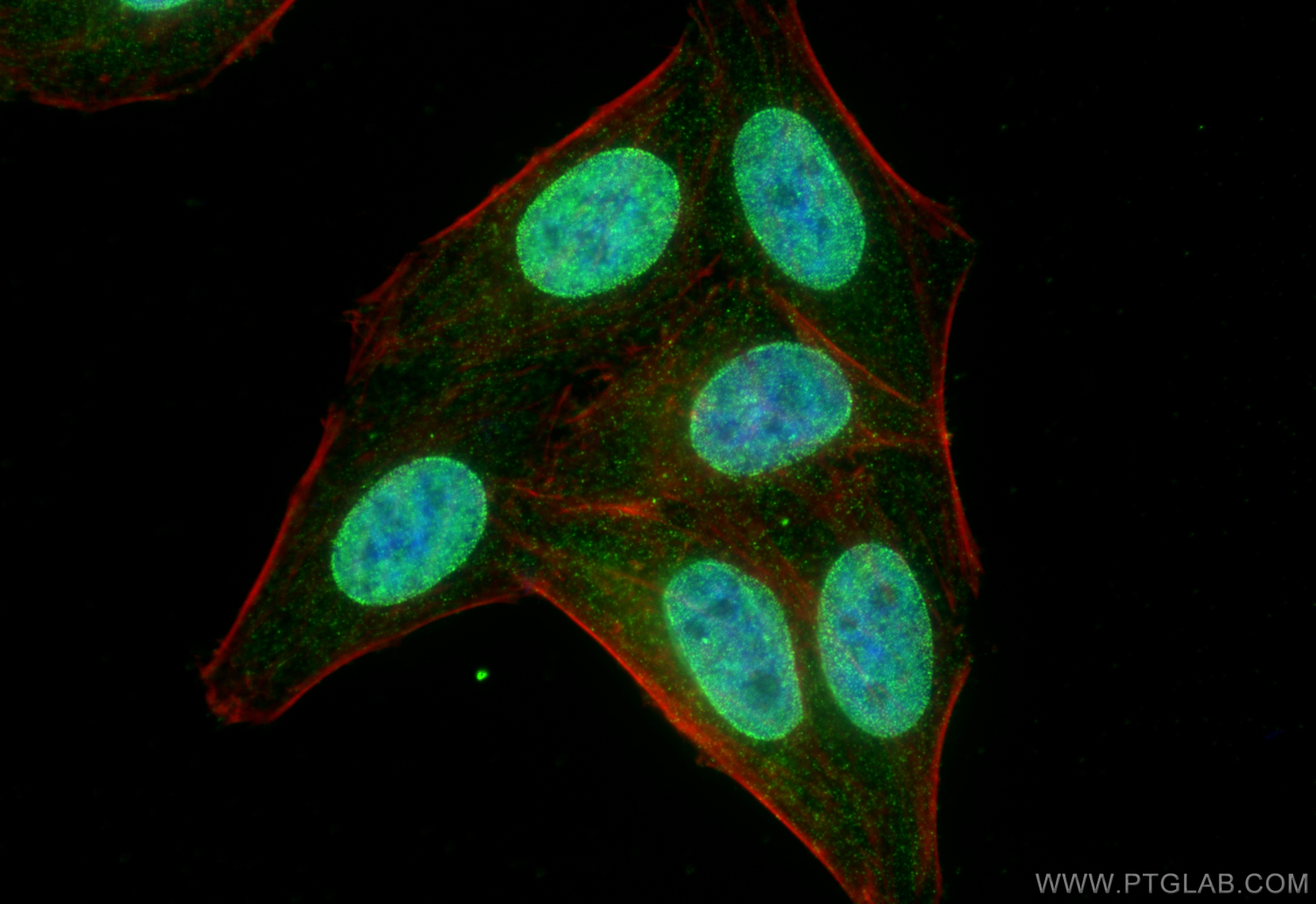 IF Staining of HepG2 using 28796-1-AP