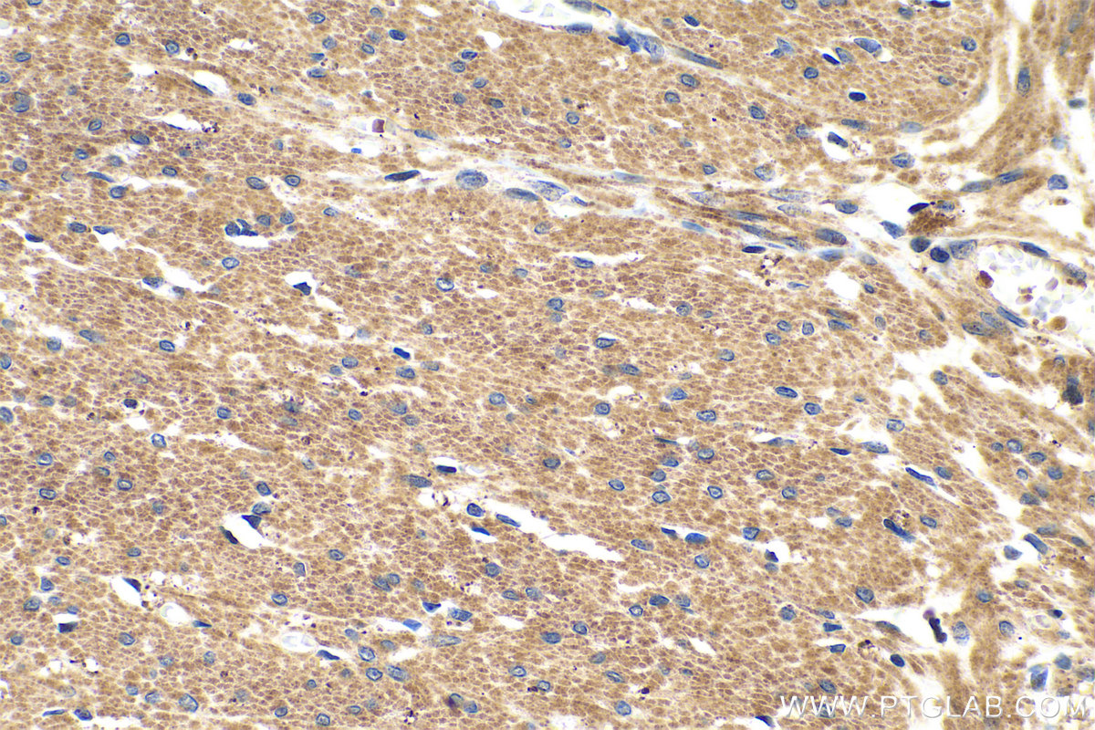 IHC staining of human colon using 55463-1-AP