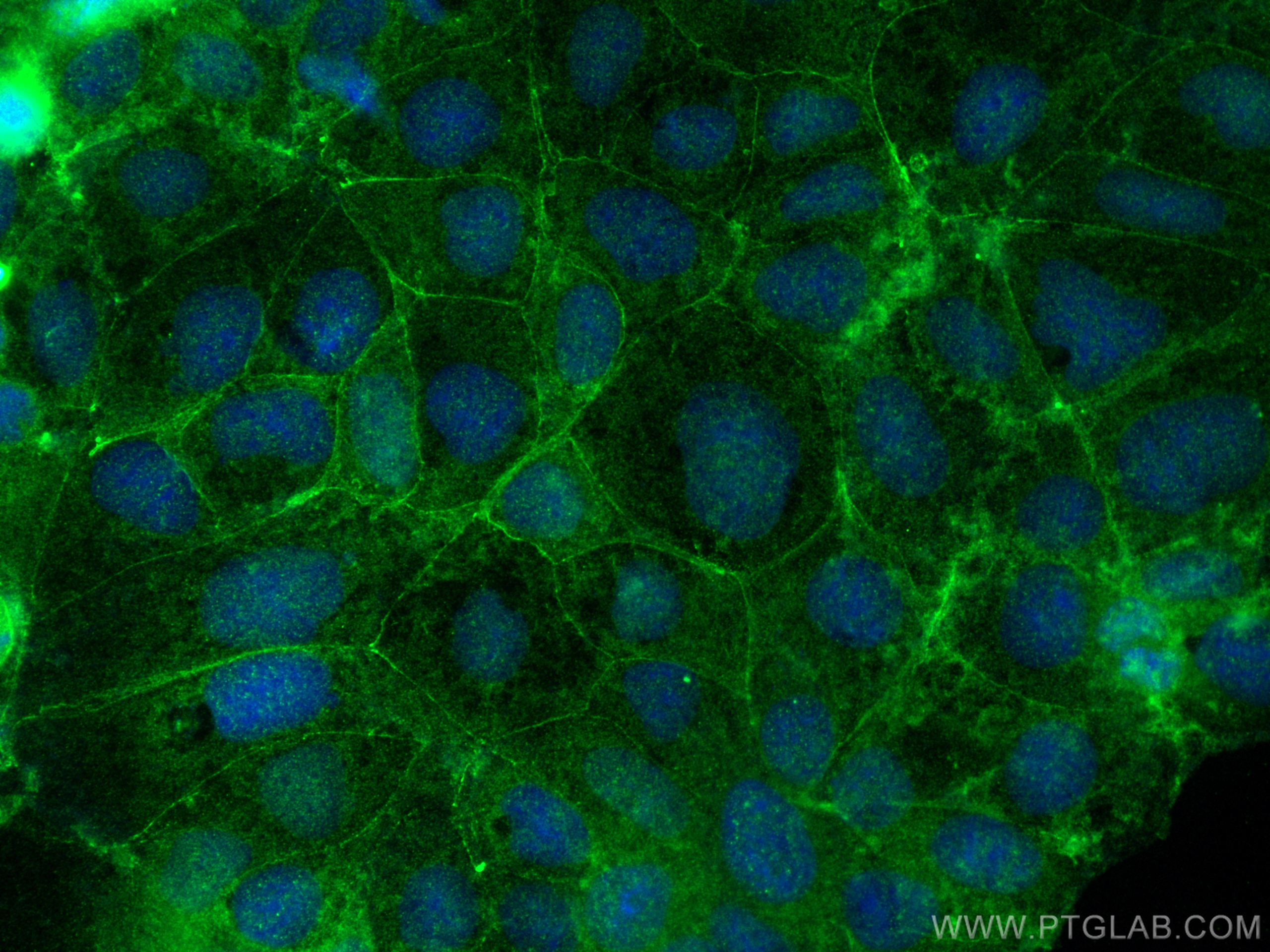 IF Staining of Caco-2 using 26479-1-AP