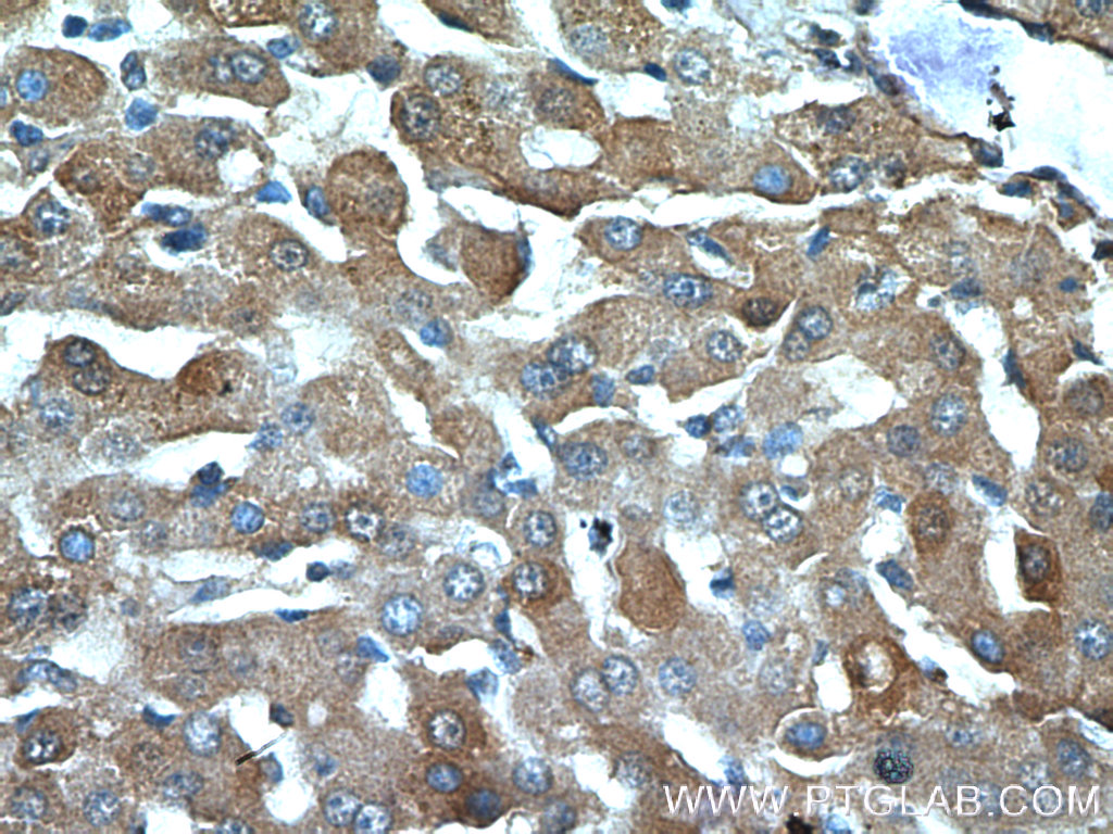 IHC staining of human liver using 22263-1-AP