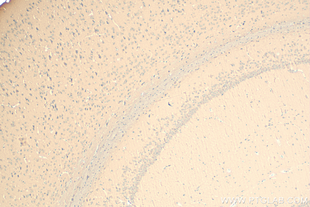 IHC staining of mouse brain using 83618-3-RR (same clone as 83618-3-PBS)