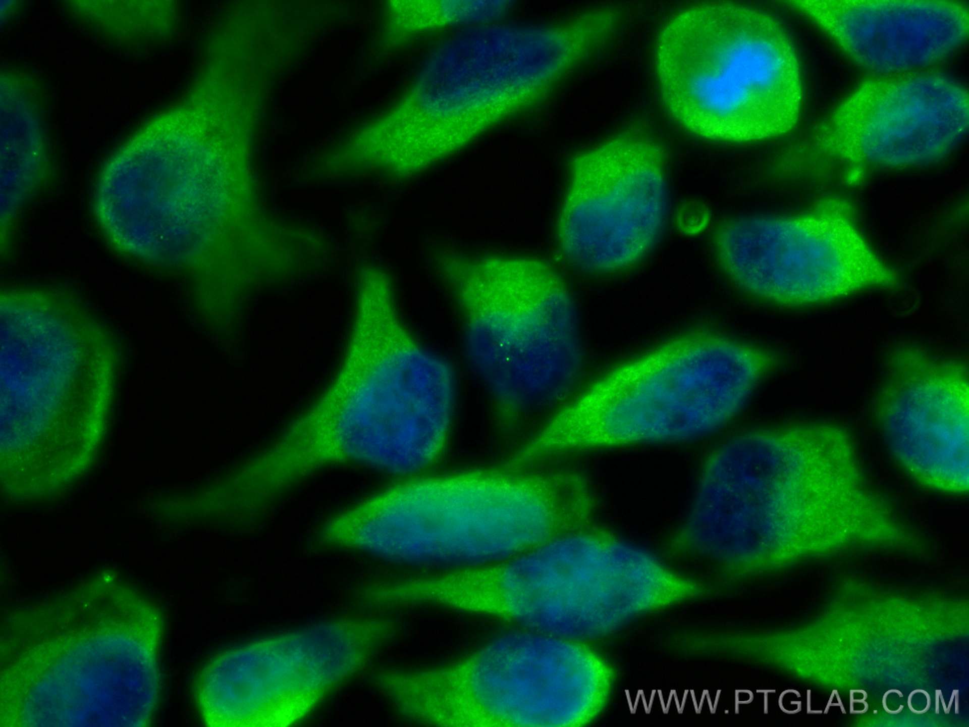 IF Staining of HeLa using 24936-1-AP