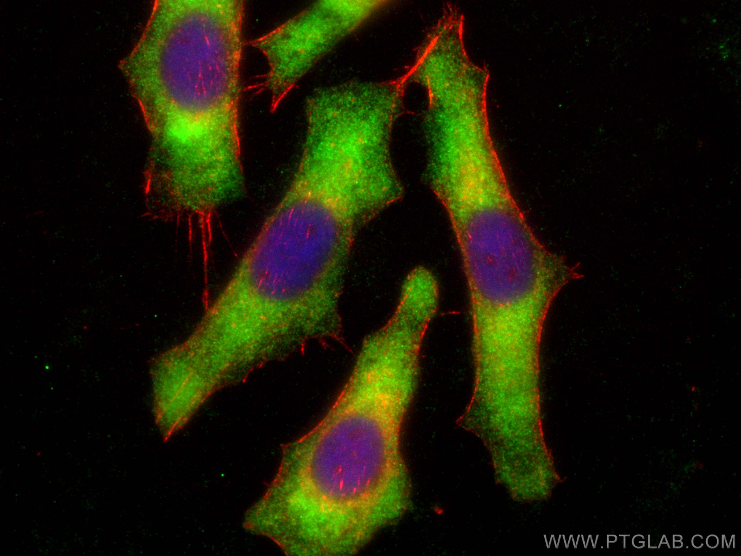 IF Staining of PC-3 using 12645-1-AP