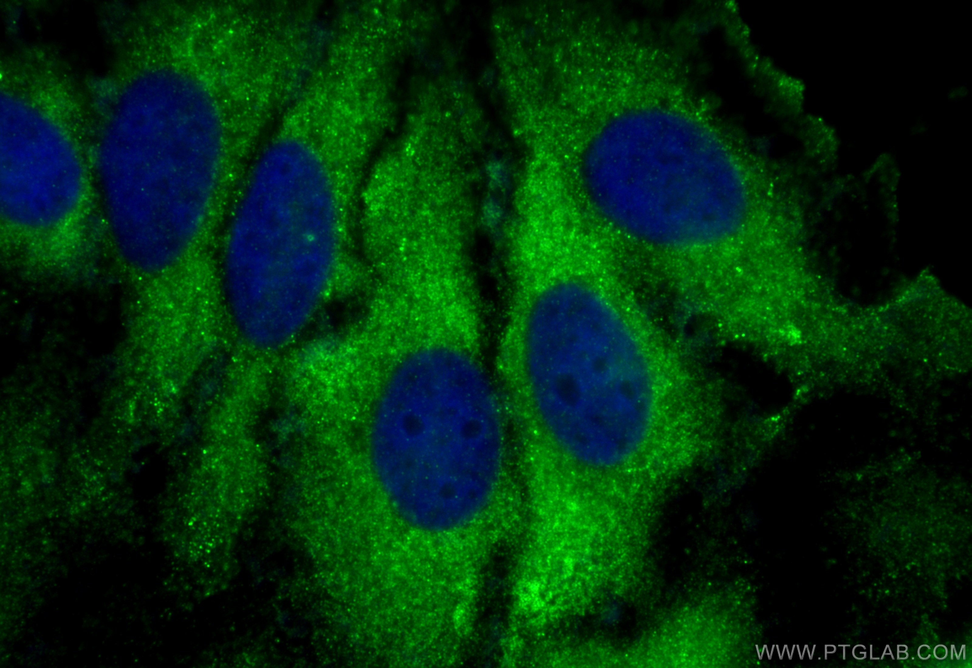 IF Staining of HeLa using 12645-1-AP