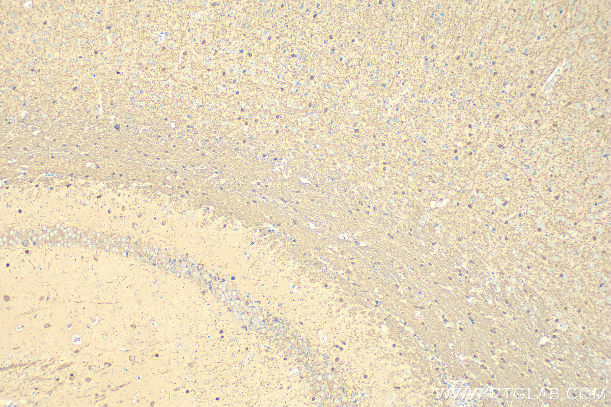 IHC staining of mouse brain using 14908-1-AP