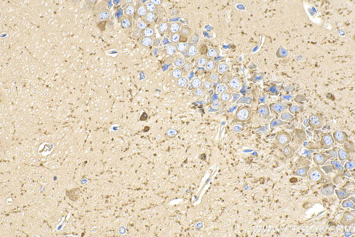 IHC staining of mouse brain using 14908-1-AP