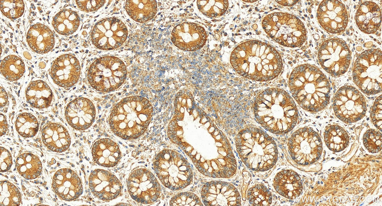 IHC staining of human colon using 27094-1-AP