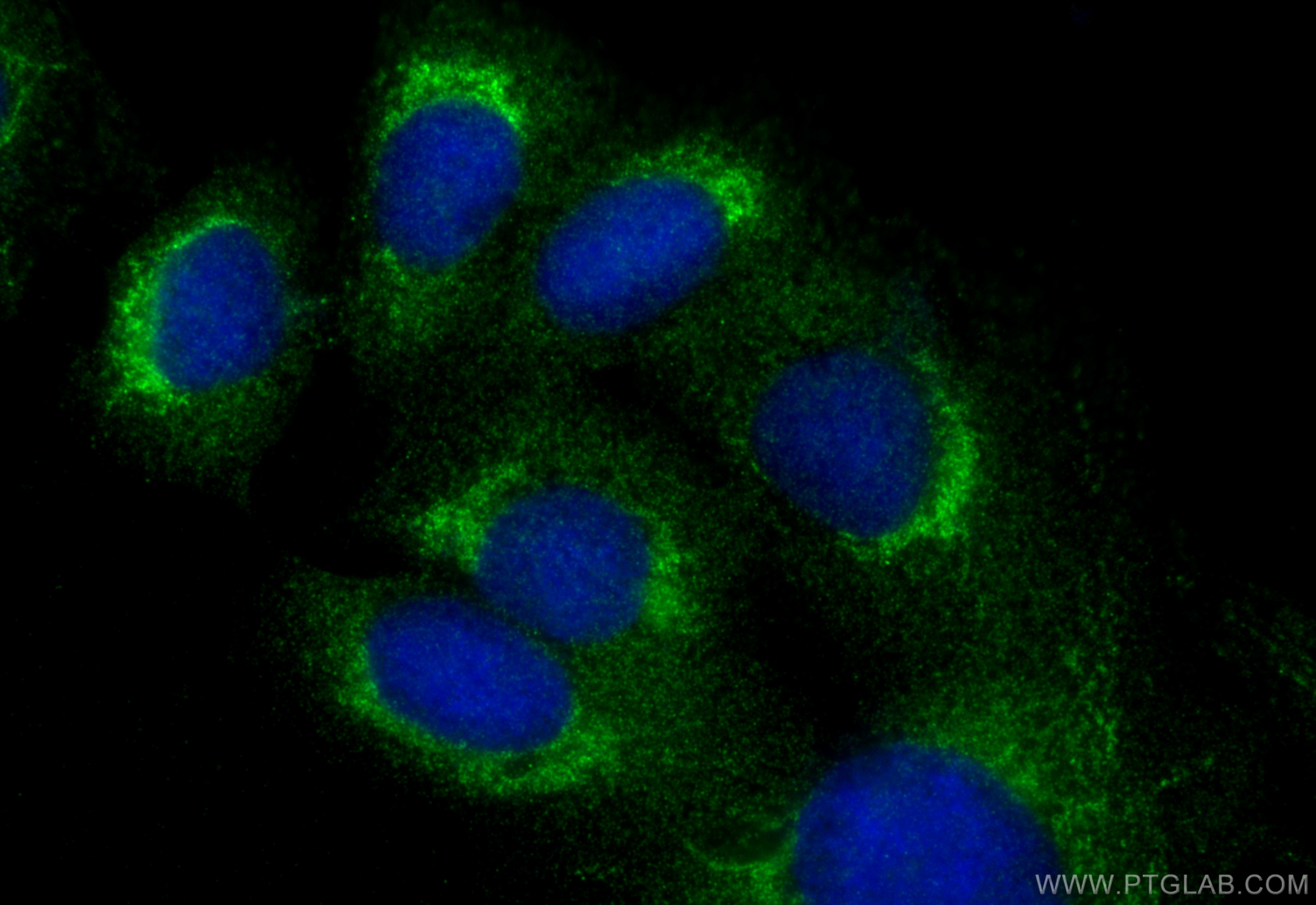 IF Staining of U2OS using 15903-1-AP