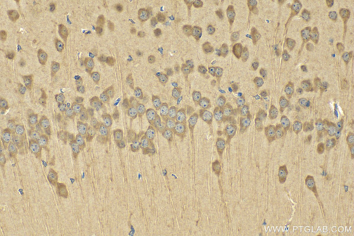 IHC staining of mouse brain using 20229-1-AP